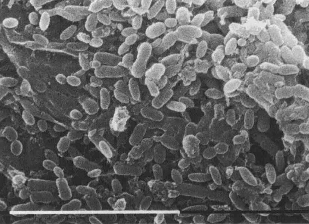 Bactéries fixées sur la muqueuse du rumen